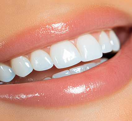 ابتسامة هوليود